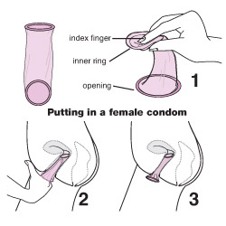 Insert a female condom