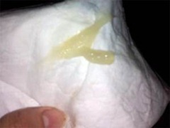 cervix mucus plug pregnancy cervix mucus plug pregnancy