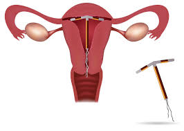 Effects of copper on sperm picture 23