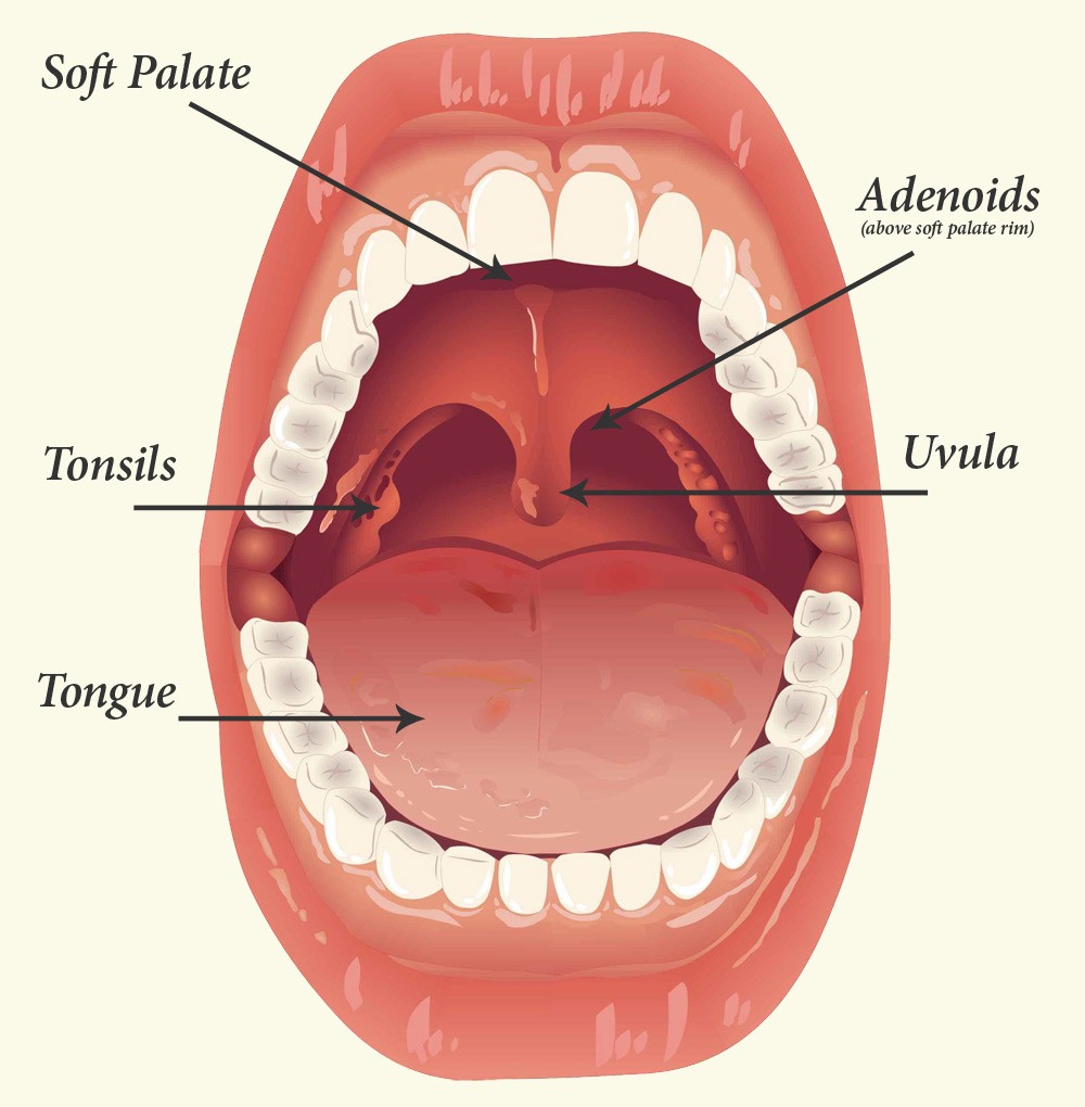 What Causes Large Tonsils in Kids and How to Treat? - New Kids Center