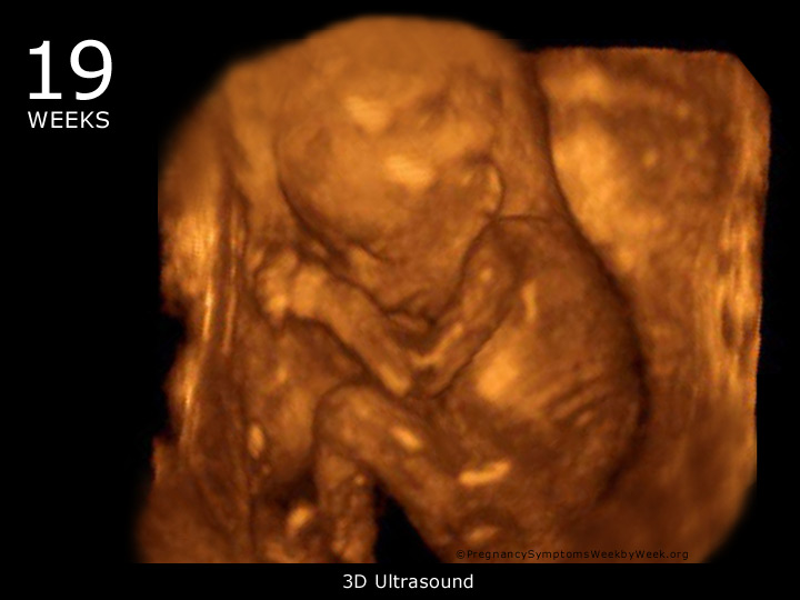 What To Expect With Ultrasound Done At 19th Week Of Pregnant With 